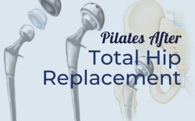 Pilates After Total Hip Replacement
