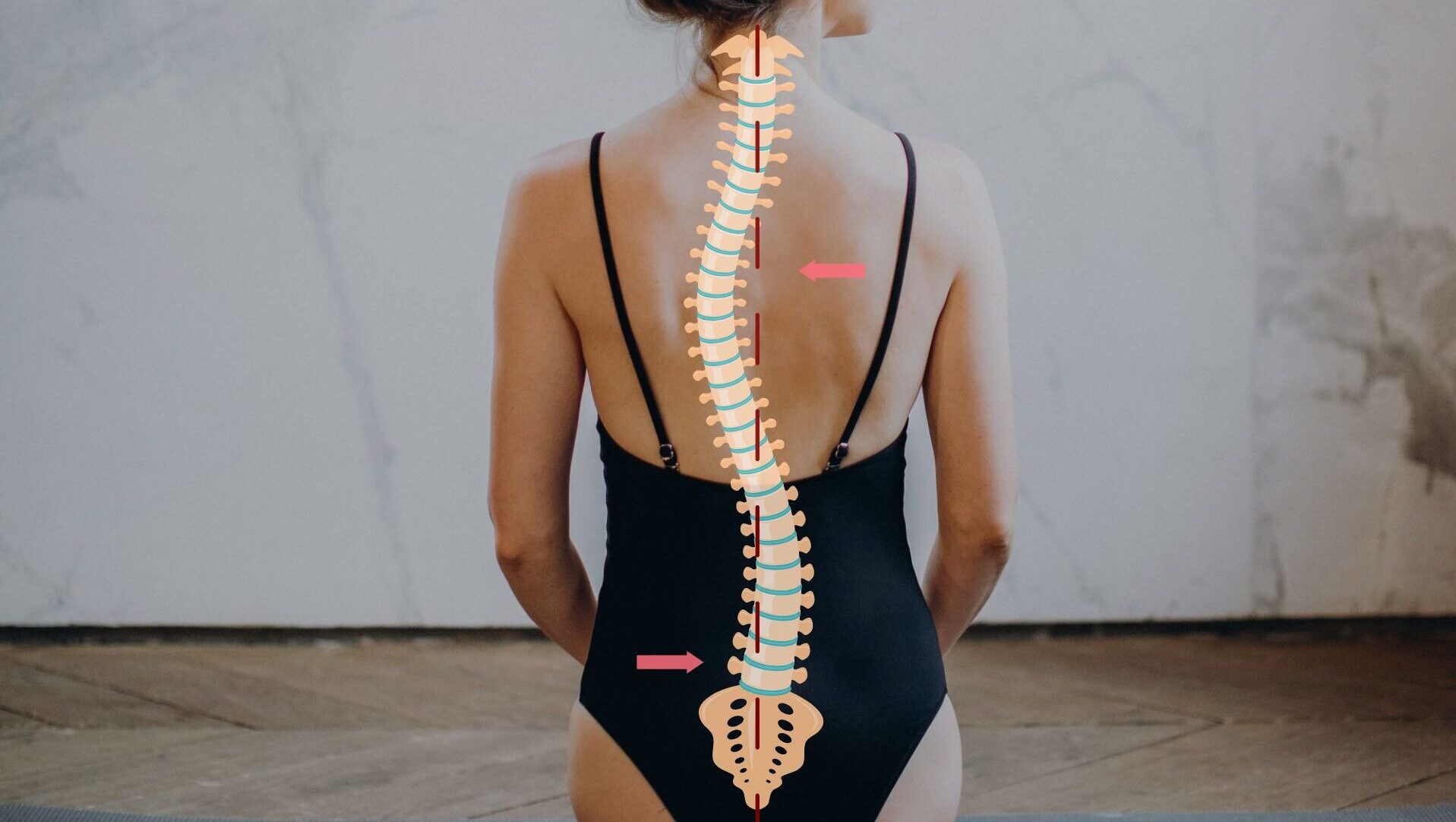 scoliosis review pilates nyc bodywork session